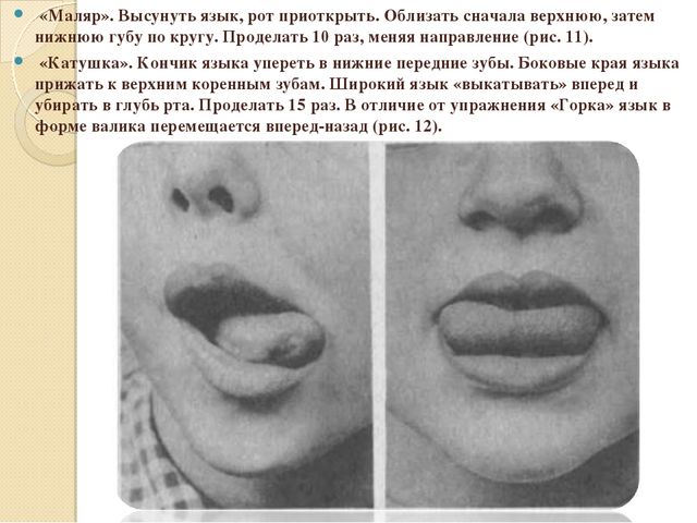 Развитие артикуляционной моторики и речевого дыхания