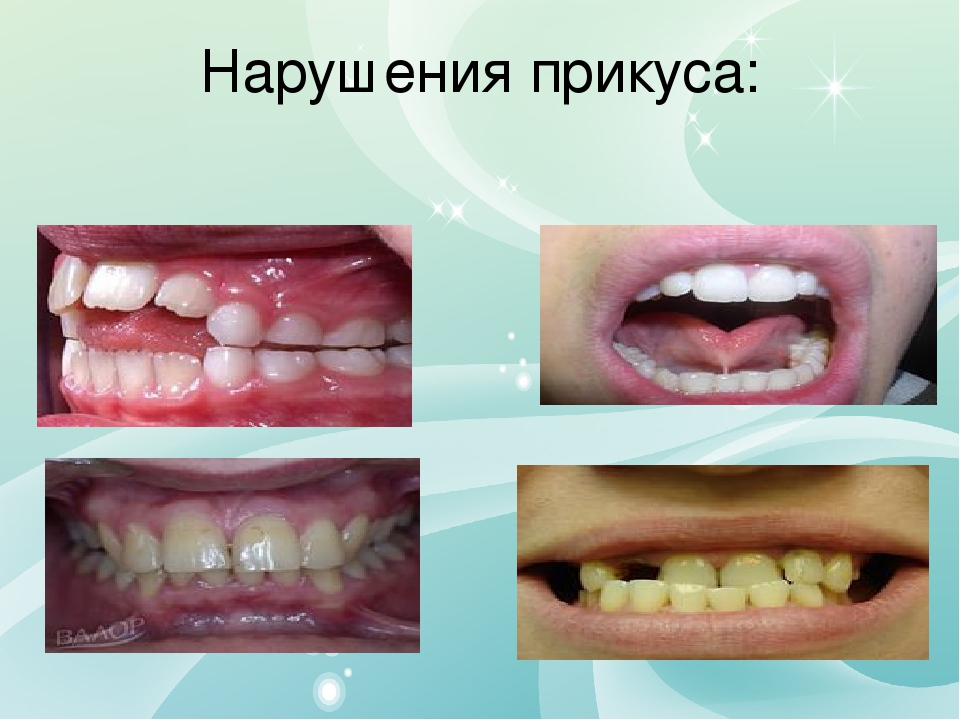 Презентация на тему "Применение миогимнастики в работе логопеда "