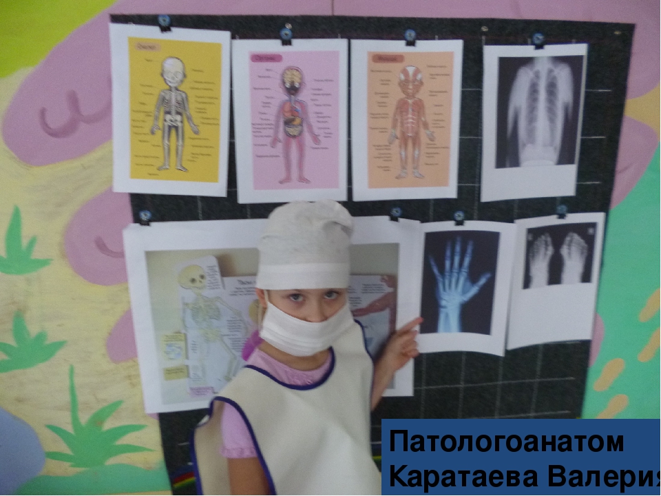 Презентация к нод "таинственное исчезновение" по ознакомлению с окружающим