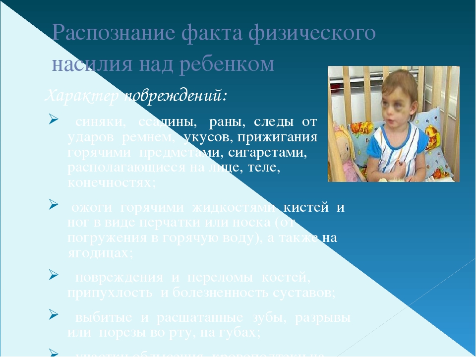 Презентация"Жестокое обращение с детьми"