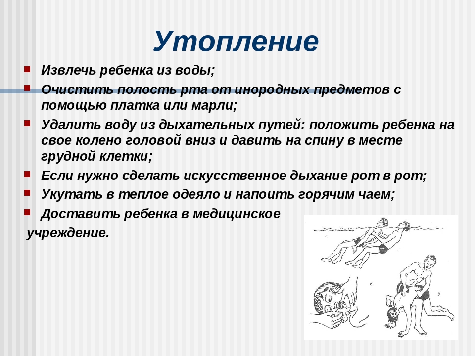 Презентация на тему "Алгоритм действий при несчастном случае в ДОУ"