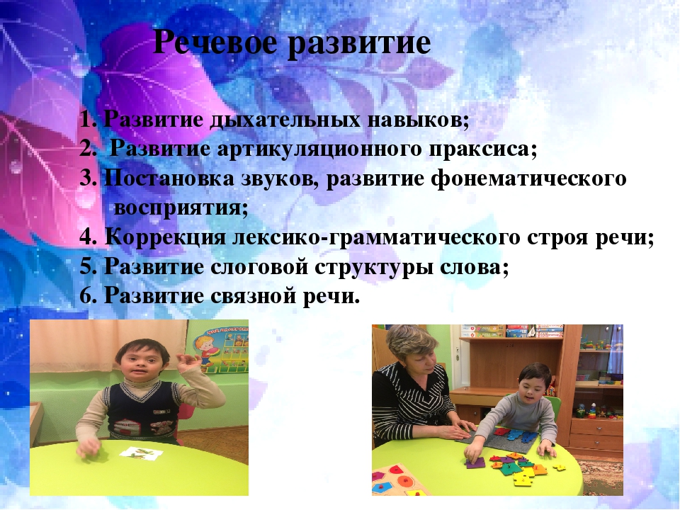 Презентация по психологии на тему "Особенности коррекционно-педагогической работы с детьми с синдромом Дауна дошкольного возраста