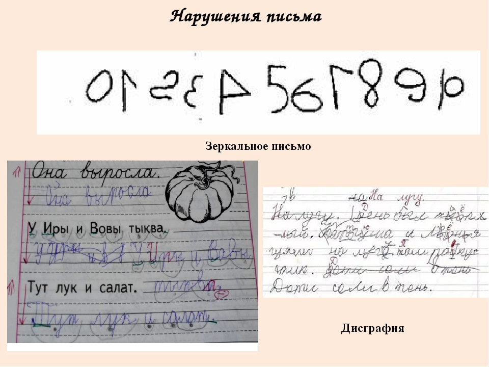 Презентация "Развитие графомоторных навыков как необходимое условие готовности к школе"