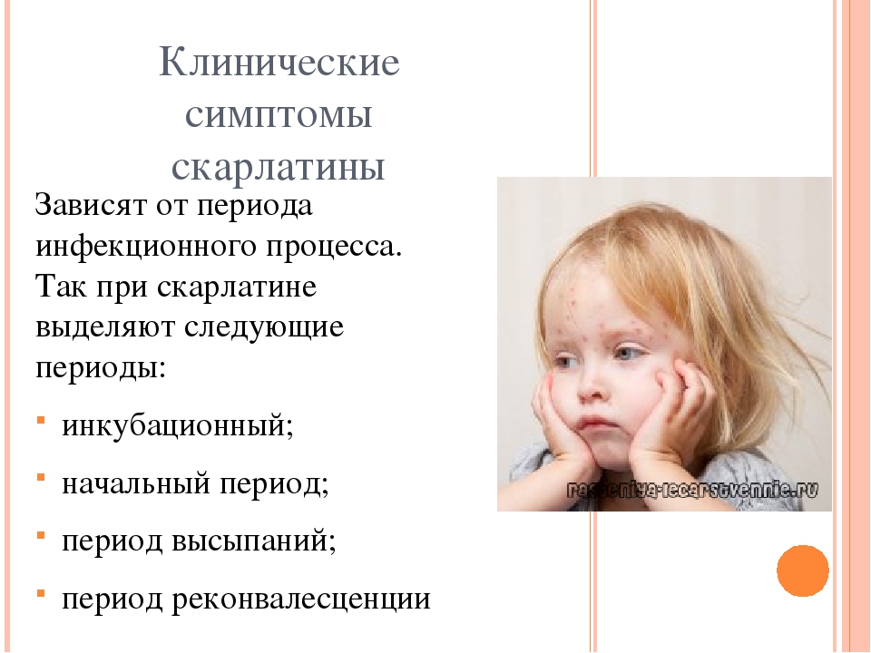 Презентация на тему "Скарлатина у детей дошкольного возраста"