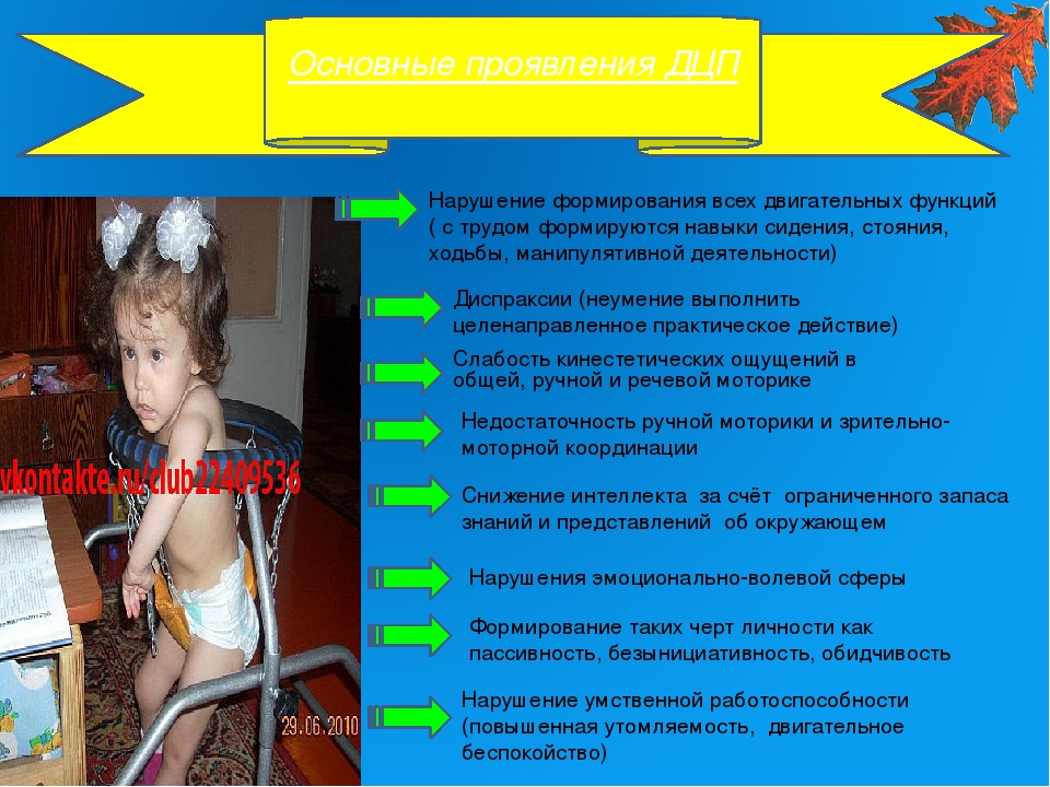 Особенности логопедической работы при детском церебральном параличе