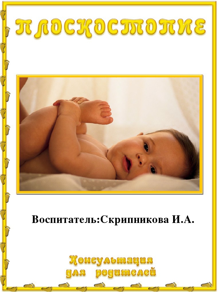 Консультация для родителей "Предупреждение плоскостопия"