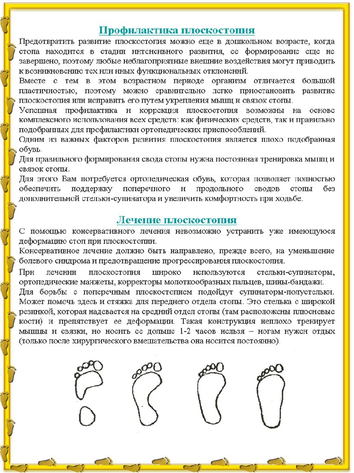 Консультация для родителей "Предупреждение плоскостопия"