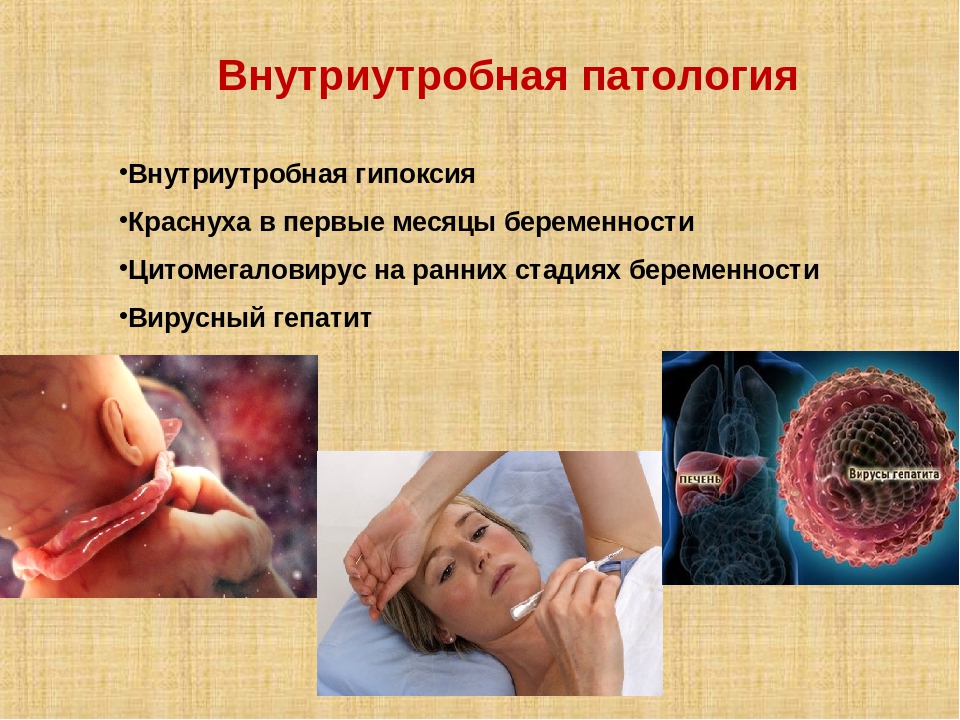 Презентация: "Биологические причины задержки речевого развития у детей"