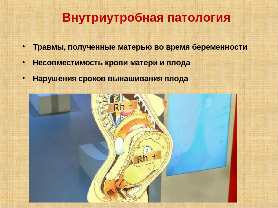 Презентация: "Биологические причины задержки речевого развития у детей"
