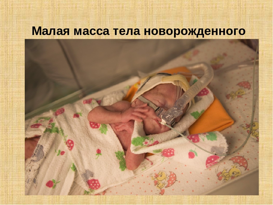 Презентация: "Биологические причины задержки речевого развития у детей"