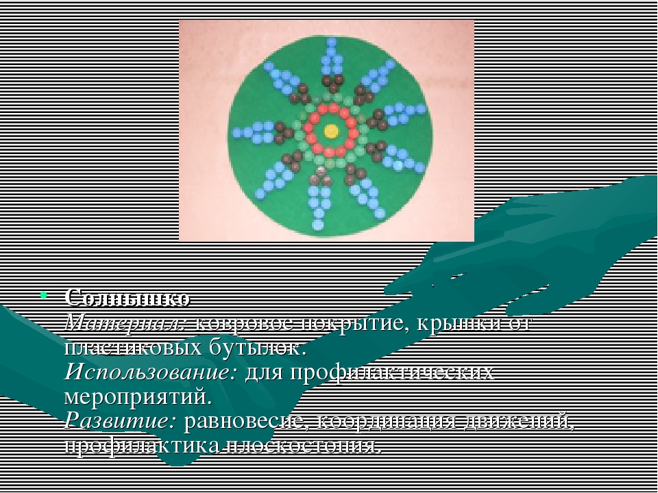 Нестандартное оборудование для профилактики плоскостопия