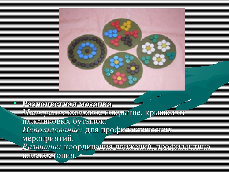 Нестандартное оборудование для профилактики плоскостопия