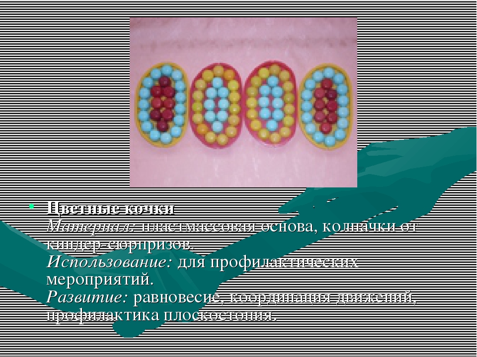 Нестандартное оборудование для профилактики плоскостопия