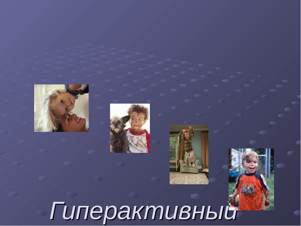 Гиперактивный ребенок в группе.Рекомендации для воспитателей и родителей.