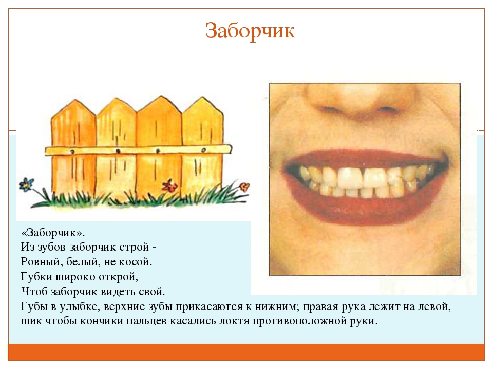 ПРЕЗЕНТАЦИЯ "ВЕСЁЛАЯ АРТИКУЛЯЦИОННАЯ ГИМНАСТИКА ДЛЯ ДЕТЕЙ"