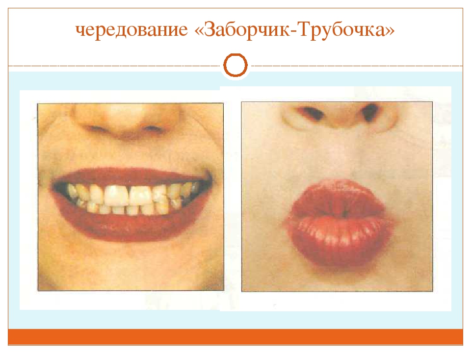 ПРЕЗЕНТАЦИЯ "ВЕСЁЛАЯ АРТИКУЛЯЦИОННАЯ ГИМНАСТИКА ДЛЯ ДЕТЕЙ"