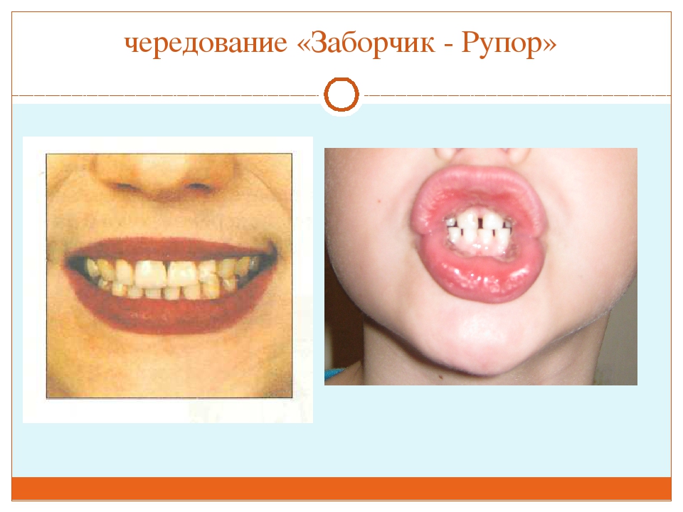 ПРЕЗЕНТАЦИЯ "ВЕСЁЛАЯ АРТИКУЛЯЦИОННАЯ ГИМНАСТИКА ДЛЯ ДЕТЕЙ"