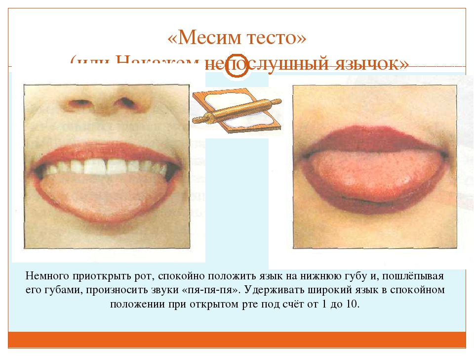 ПРЕЗЕНТАЦИЯ "ВЕСЁЛАЯ АРТИКУЛЯЦИОННАЯ ГИМНАСТИКА ДЛЯ ДЕТЕЙ"