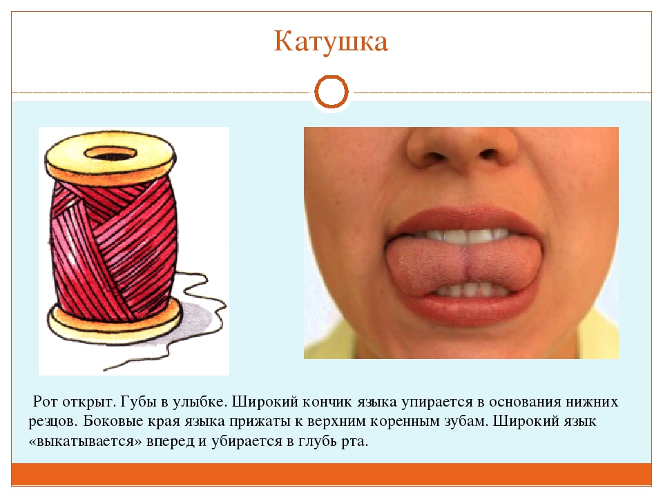 ПРЕЗЕНТАЦИЯ "ВЕСЁЛАЯ АРТИКУЛЯЦИОННАЯ ГИМНАСТИКА ДЛЯ ДЕТЕЙ"
