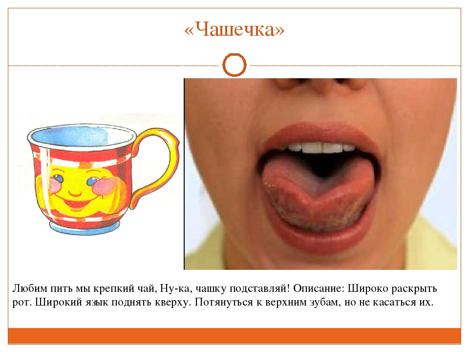 ПРЕЗЕНТАЦИЯ "ВЕСЁЛАЯ АРТИКУЛЯЦИОННАЯ ГИМНАСТИКА ДЛЯ ДЕТЕЙ"
