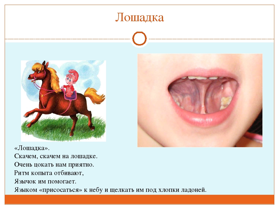 ПРЕЗЕНТАЦИЯ "ВЕСЁЛАЯ АРТИКУЛЯЦИОННАЯ ГИМНАСТИКА ДЛЯ ДЕТЕЙ"