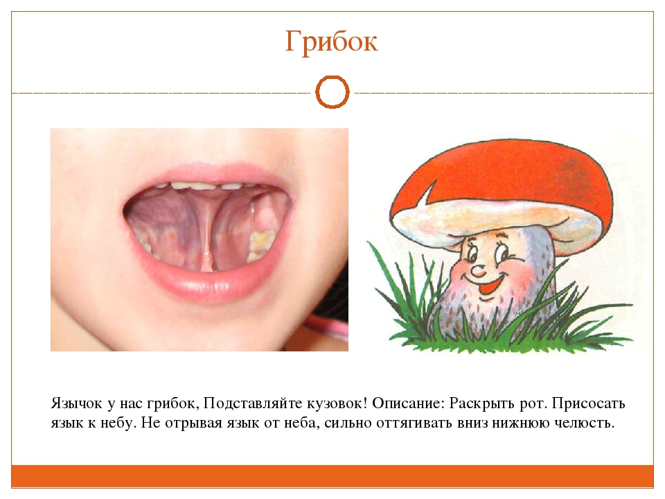ПРЕЗЕНТАЦИЯ "ВЕСЁЛАЯ АРТИКУЛЯЦИОННАЯ ГИМНАСТИКА ДЛЯ ДЕТЕЙ"
