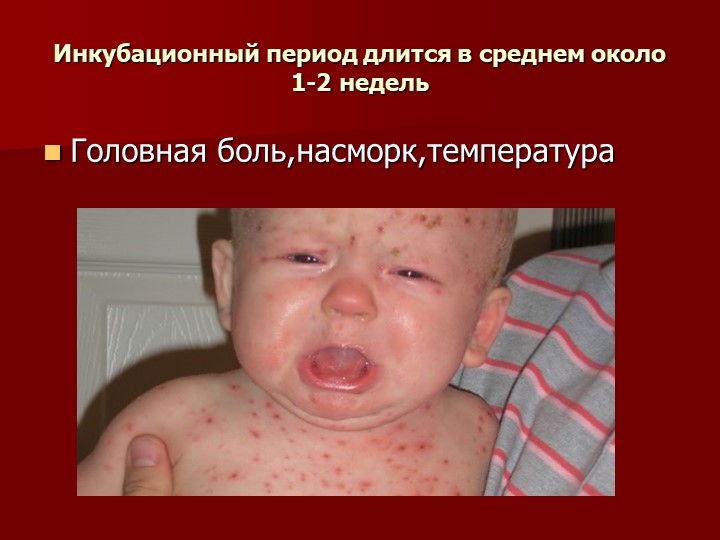 Презентация на тему "Корь. Помощь родителям"