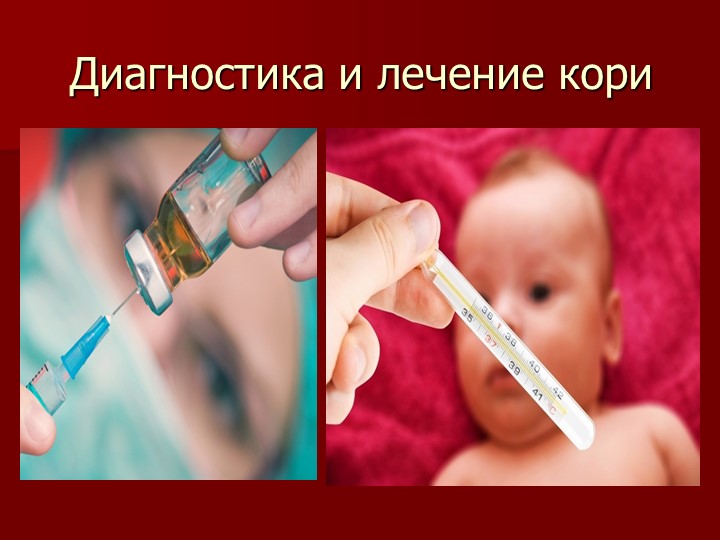 Презентация на тему "Корь. Помощь родителям"