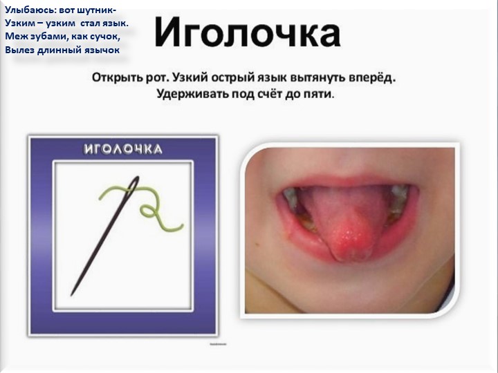 Презентация. Индивидуальное логопедическое занятие. Постановка звука Ш.
