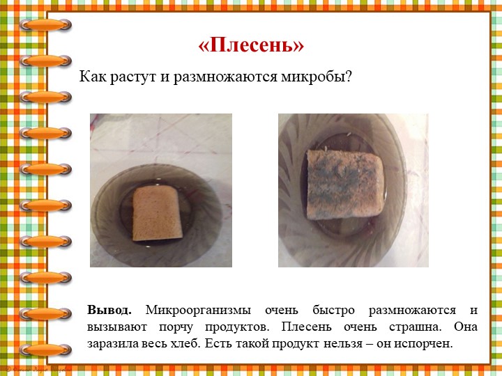 Презентация " Что мы знаем о микробах"