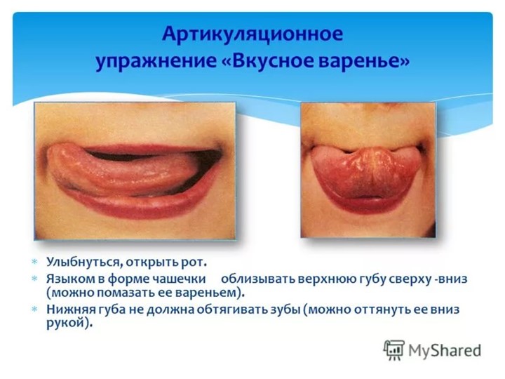Презентация "Комплекс артикуляционных упражнений"