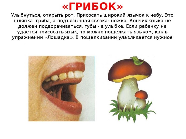 Презентация "Комплекс артикуляционных упражнений"