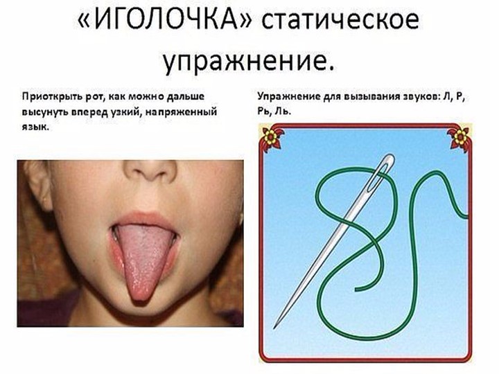 Презентация "Комплекс артикуляционных упражнений"