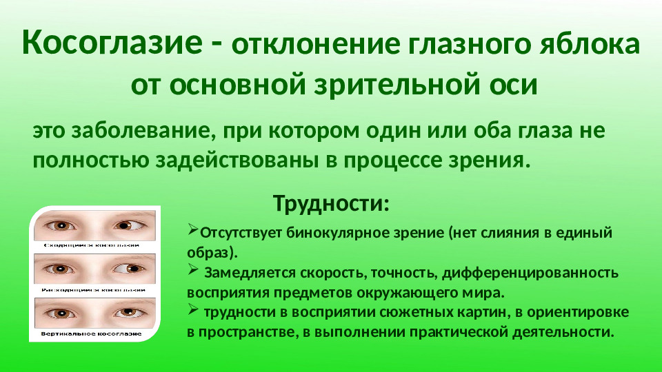 Презентация "Особенности работы с детьми с нарушением зрения"