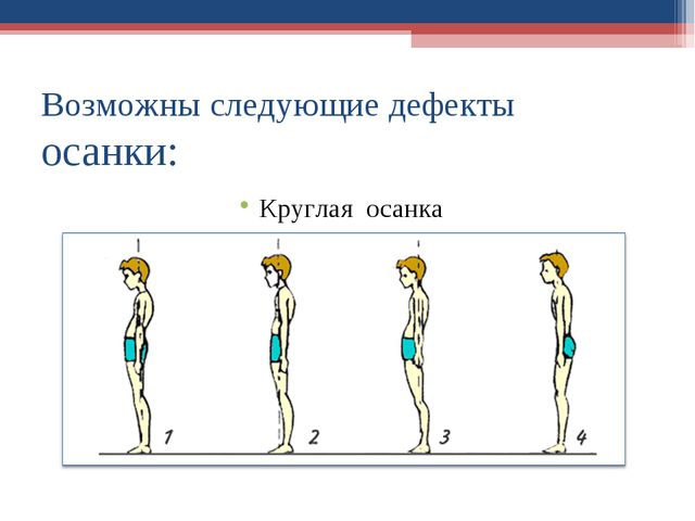 Формирование правильной осанки