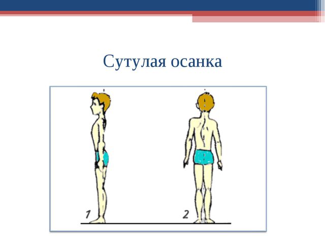 Формирование правильной осанки