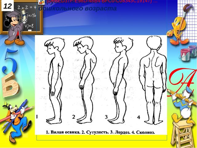 Физическая готовность детей к обучению в школе