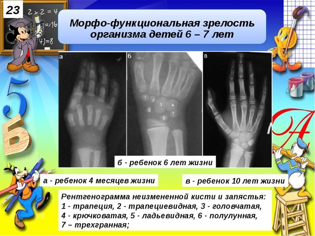 Физическая готовность детей к обучению в школе