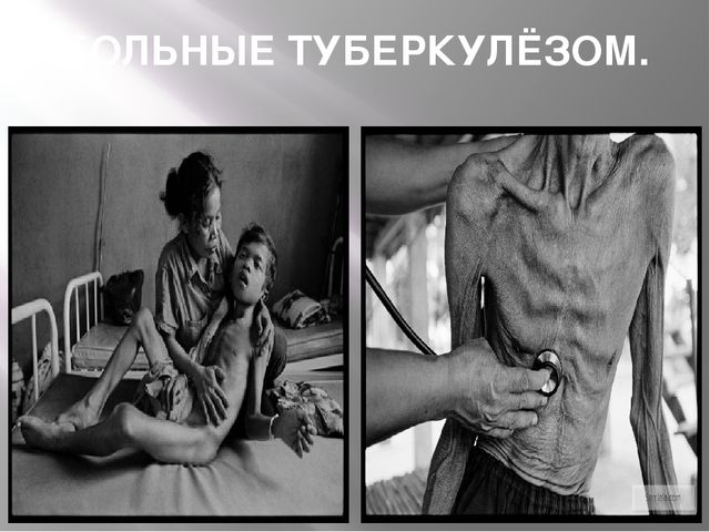 Презентация "24 марта - всемирный день борьбы с туберкулёзом"