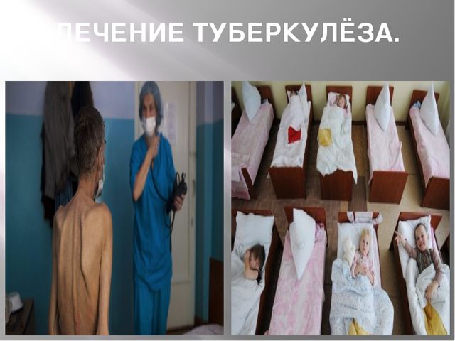 Презентация "24 марта - всемирный день борьбы с туберкулёзом"