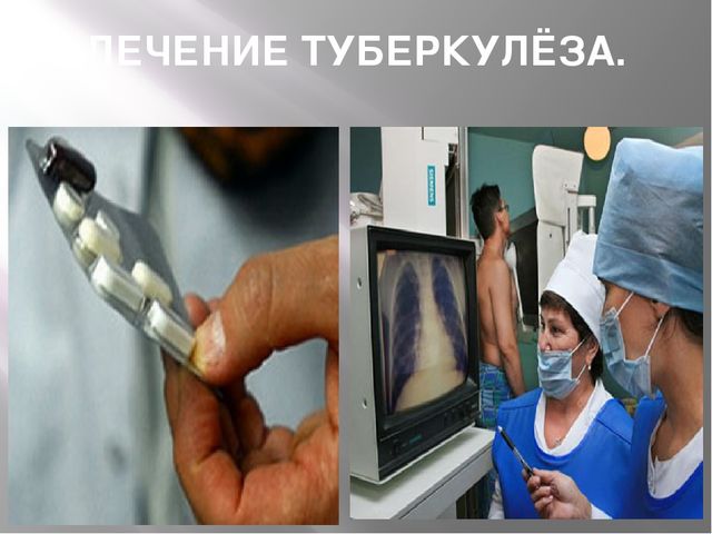Презентация "24 марта - всемирный день борьбы с туберкулёзом"