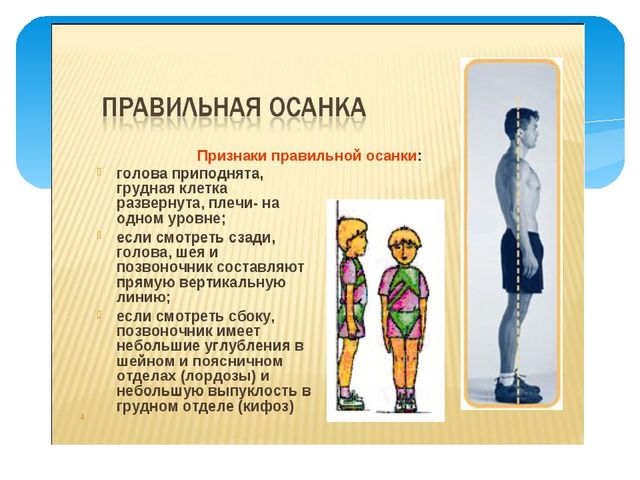 Презентация ЗОЖ "Правильная осанка"