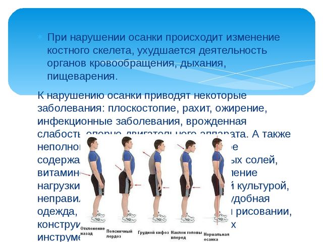 Презентация ЗОЖ "Правильная осанка"