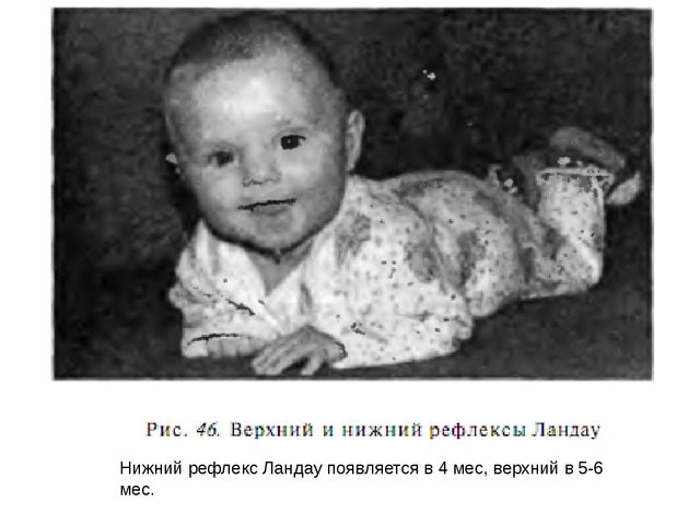 Презентация "Анатомо-физиологические особенности нервной системы у детей. Нервно-психическое развитие."