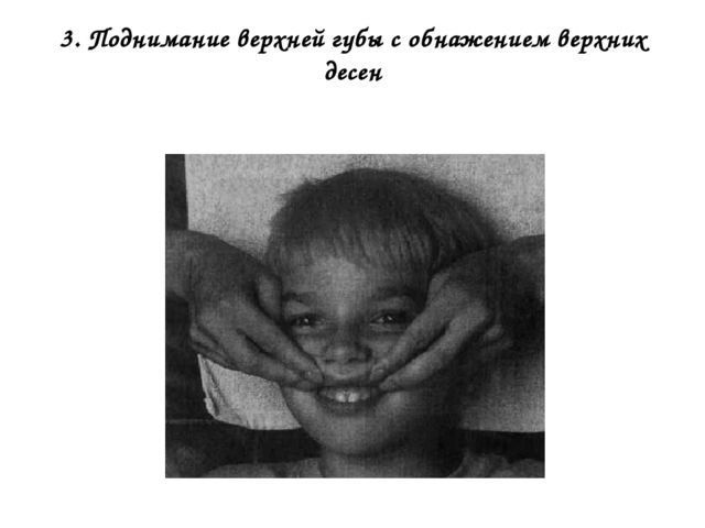 Пассивная артикуляционная гимнастика для детей дошкольного возраста!!!