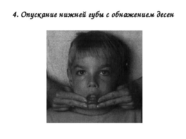 Пассивная артикуляционная гимнастика для детей дошкольного возраста!!!