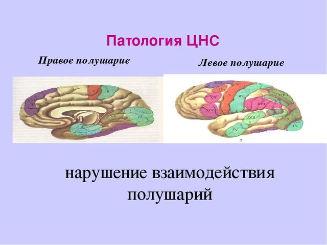Презентация "Как развивать межполушарное взаимодействие"