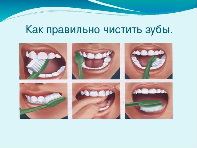 Презентация по валеологии на тему "Берегите свои зубки"
