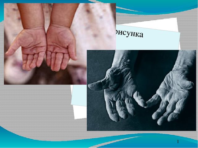 Презентация "Нетрадиционные способы развития мелкой моторики у дошкольников"
