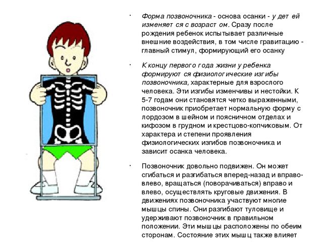 Презентация "Осанка. Профилактика заболеваний"